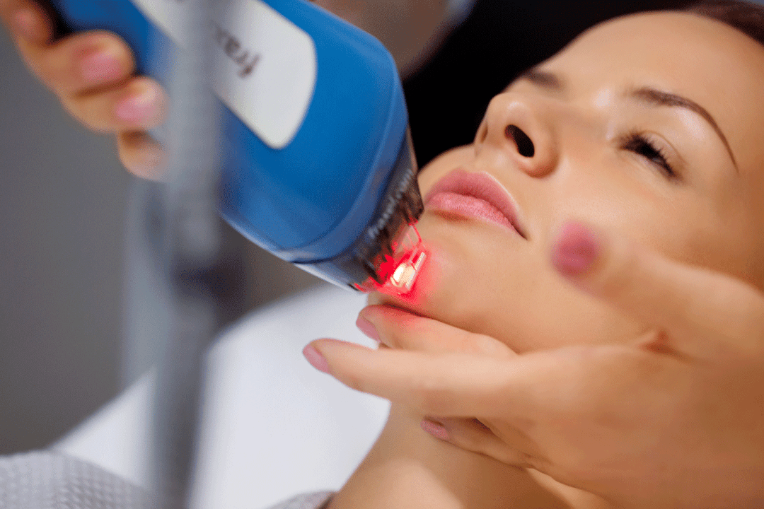 rejuvenescimento da pele facial a laser